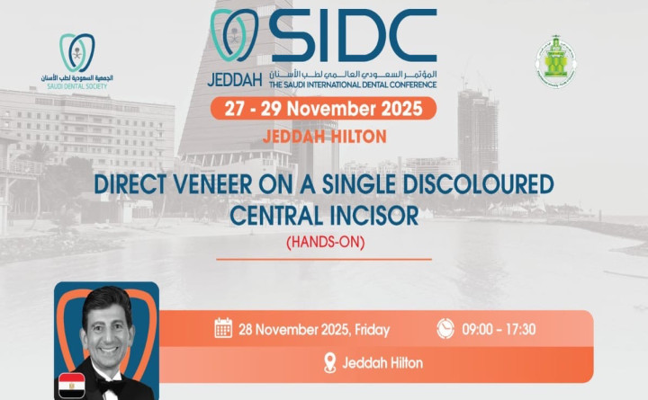 DIRECT VENEER ON A SINGLE DISCOLOURED CENTRAL INCISOR