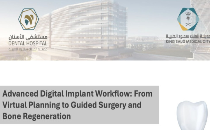 Advanced Digital Implant Workflow: From Virtual Planning to Guided Surgery and Bone Regeneration